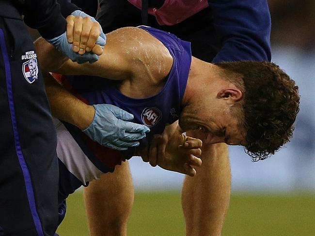 Tom Liberatore gets some assistance after a collision with Richmond’s Jayden Short. Picture: Wayne Ludbey