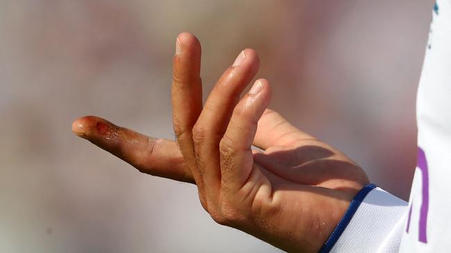 England's Moeen Ali examines his injured spinning finger. Picture: AFP