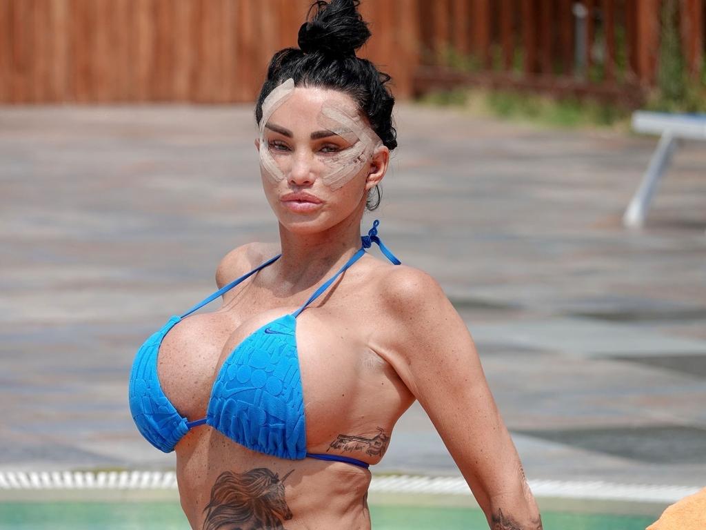 How does one shift into recovery mode after undergoing a $20,000 facelift? If you’re Katie Price, you strip down to your string bikini and lounge by the pool of a 5-star hotel in Turkey.<br/>The reality star and TV personality, 46, underwent her sixth facial surgery in August and later took to Instagram to detail her recovery.<br/>“My natural hair growing, My eyelashes. Natural face healing well,” she captioned a selfie.<br/>Price might have been feeling good about it all - but according to TripAdvisor, other hotel guests weren’t as thrilled to be sharing a pool with her during her recovery phase.<br/>“Who wants to relax and dine at a hotel looking at someone with blood all over their face, staples holding their scalp on and incisions weeping with pus,” a fellow guest wrote on the hotel review website.<br/>Picture: Backgrid