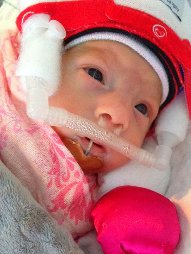 Marlowe Csincsi needed breathing support after being born at 27 weeks gestation, weighing 986g.