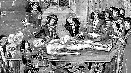 A painting depicting Guy de Chauliac the 'Father of French Surgery' conducting operation. He is credited as being the first to discover the 'Black Death' bubonic plague. Picture: Supplied