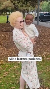 Single mum Aline's experience with albinism