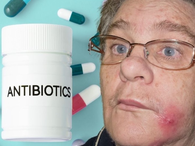 Antibiotic-resistant superbugs like golden staph are big issues.