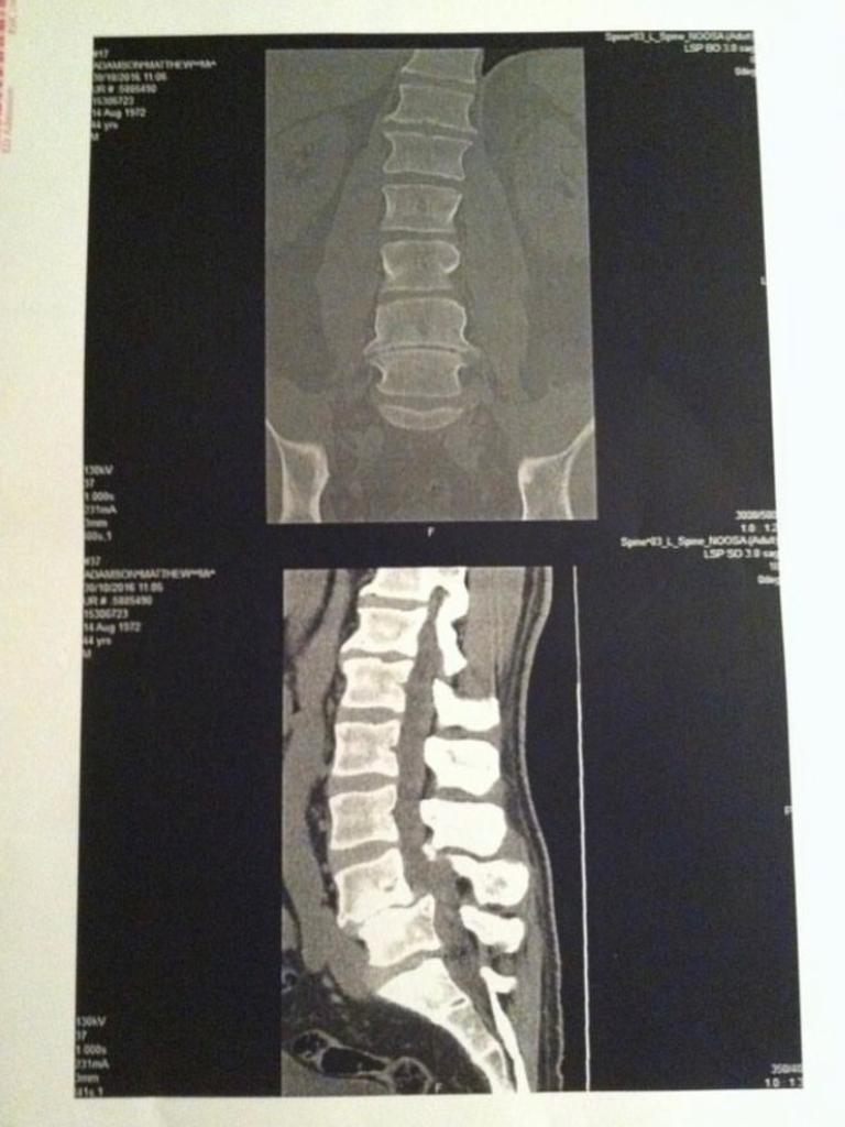 Former NRL player Matt Adamson, the manager of Canterbury youngster Karl Oloapu, also suffered a spinal injury similar to that of his client. Picture: Instagram.