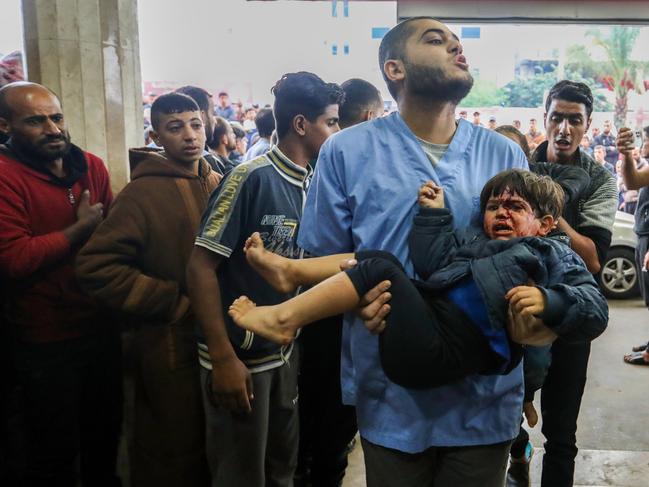 A Palestinian child injured in an Israeli air strike arrives at Nasser Medical Hospital in Khan Younis, Gaza. Picture: Getty Images