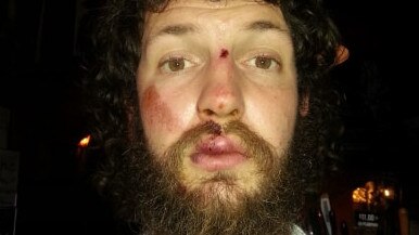 Rob Lloyd was bashed and robbed near the corner of Johnson St and Nicholson St. Supplied.