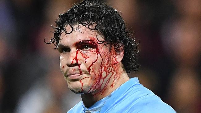 James Roberts of the Blues looks on during Game 3 of the 2018 State of Origin series between the NSW Blues and the Queensland Maroons at Suncorp Stadium in Brisbane, Wednesday, July 11, 2018. (AAP Image/Dave Hunt) NO ARCHIVING, EDITORIAL USE ONLY