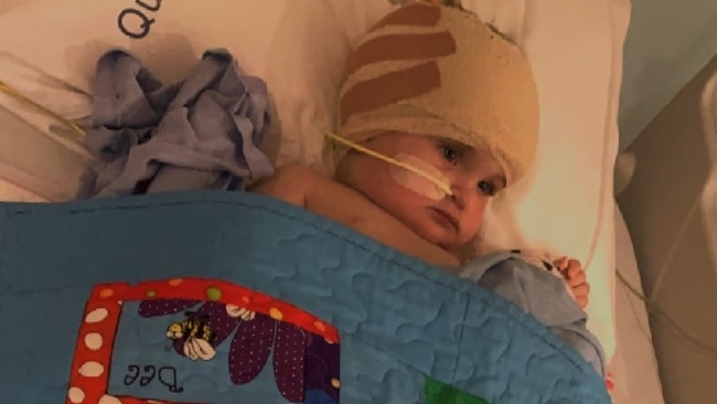 Katherine toddler Zahli Rose Brown has undergone major brain surgery after doctors discovered a large tumour in her head. Picture: Supplied.