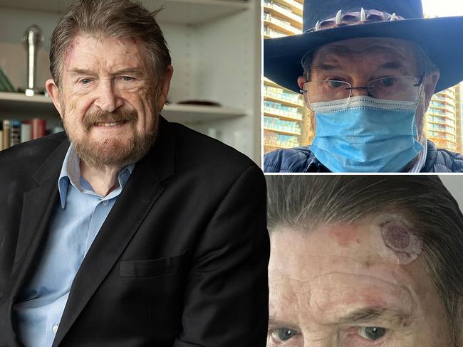 web Derryn Hinch cancer 1024