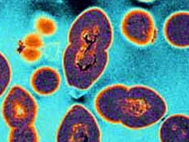 Scary. The vancomycin resistant entercocci (VRE) bacteria is a life-threatening superbug. Pic. Supplied