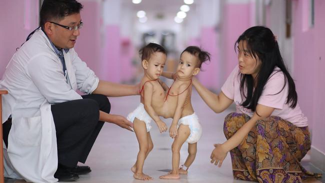 Paediatric surgeon Dr Karma Sherub and mum Bhumchu hold Nima and Dawa in the Bhutan hospital ward they've spent most of their lives in. Picture: Alex Coppel