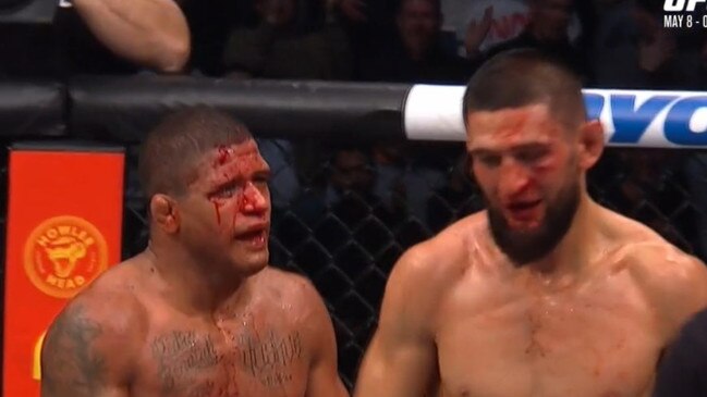 Both men's stocks in the UFC rose after this fight. Photo: Fox Sports