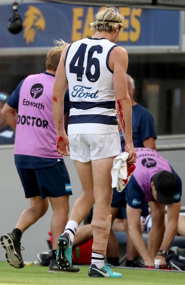 Cat Mark Blicavs was sliced up by fencing at Optus Stadium. Picture: Getty Images