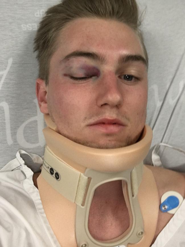Liam Mahoney says the attack was over in seconds.