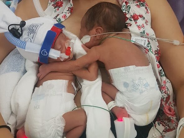 The magic moment premature twins kept apart were reunited