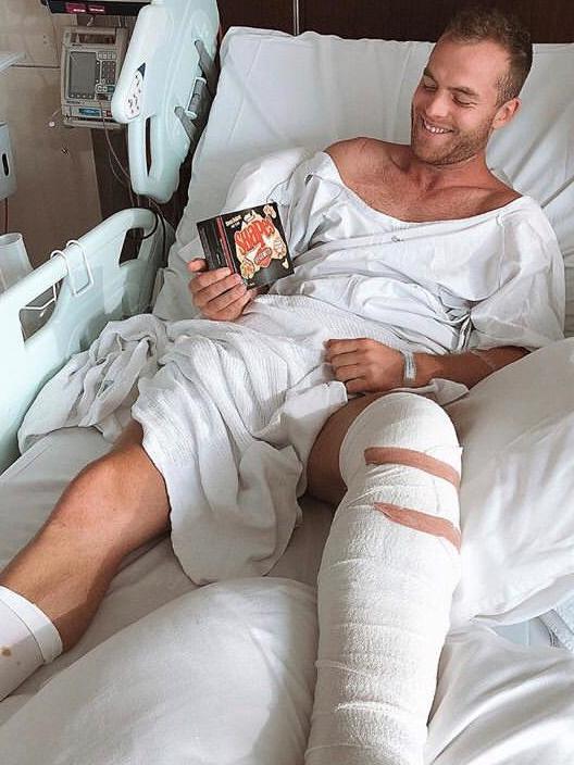 Brownlow medallist Tom Mitchell broken leg hospital