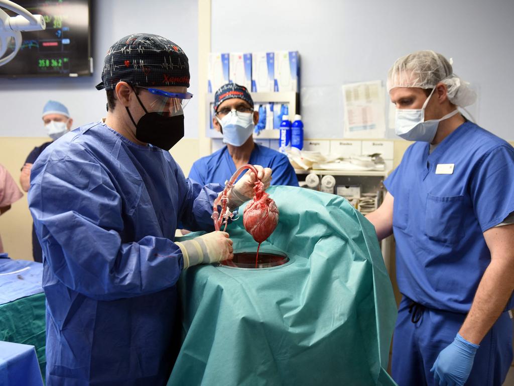 Surgeons performing the transplant procedure in January. Picture: University of Maryland School of Medicine/AFP