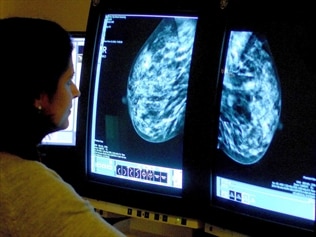 Researchers are testing a new drug on BRCA carriers, who have a high risk of breast cancer.