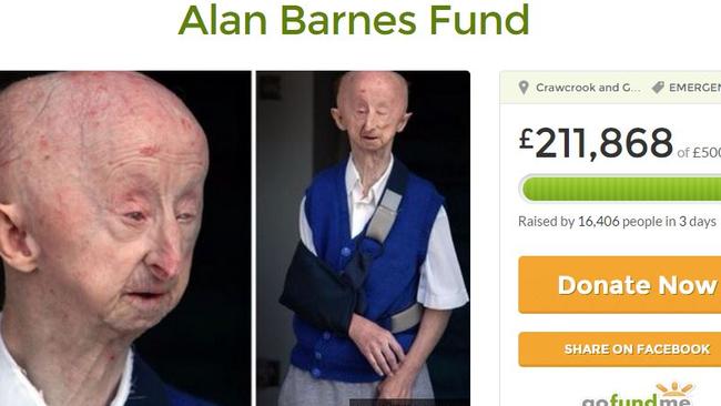 Fundraiser ... more than 200,000 pounds has been raised for Alan Barnes. Picture: GoFundMe/Alan Barnes Fund