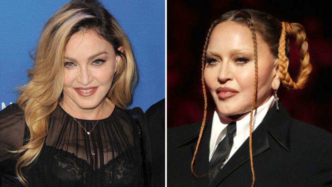 Madonna’s unveils new face at Grammy Awards body+soul