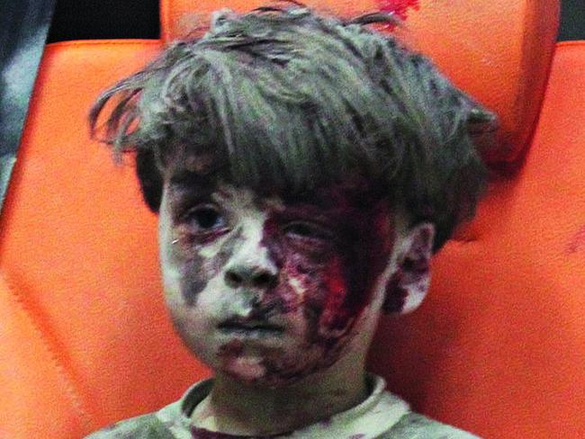 TWAM-20161217  EMBARGO FOR TWAM 17 Dec 2016NO REUSE WITHOUT PERMISSIONALEPPO, SYRIA - AUGUST 17:   (EDITORS NOTE: Image contains graphic content.) 5-year-old wounded Syrian kid Omran Daqneesh sits alone in the back of the ambulance after he got injured during Russian or Assad regime forces air strike targeting the Qaterji neighbourhood of Aleppo on August 17, 2016. (Photo by Mahmud Rslan/Anadolu Agency/Getty Images)