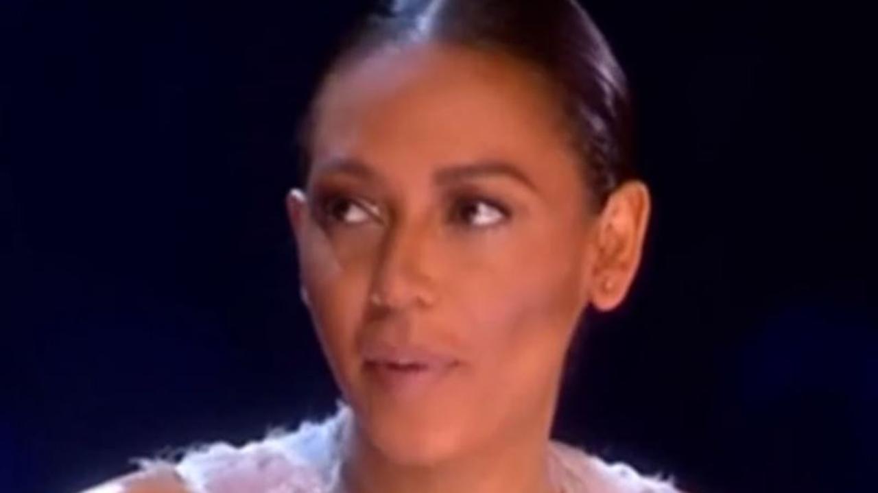 Mel b X Factor bruisesannettepix