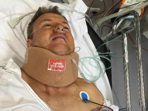 Supplied photo of Jamie Harrison in hospital (Finke Desert Race).