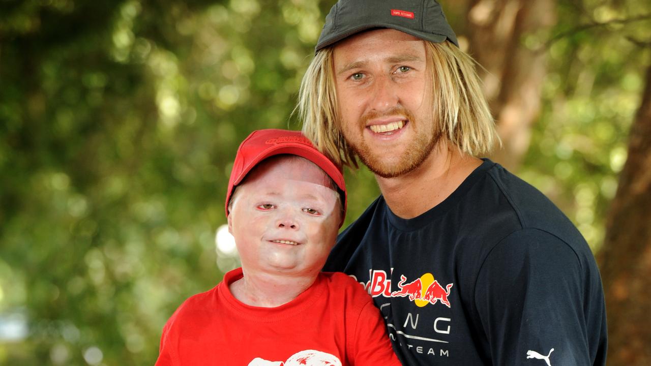 Former Essendon captain Dyson Turner-Heppell has credited an inspirational friendship with a gutsy teen fighting a rare and debilitating condition for helping him find purpose after AFL footy. Picture: Andrew Henshaw
