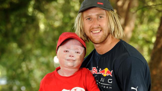 Former Essendon captain Dyson Turner-Heppell has credited an inspirational friendship with a gutsy teen fighting a rare and debilitating condition for helping him find purpose after AFL footy. Picture: Andrew Henshaw