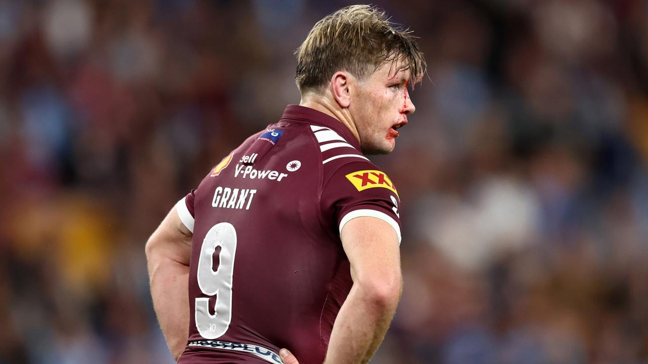 Harry Grant showing the toll of State of Origin. Picture: Chris Hyde/Getty Images)