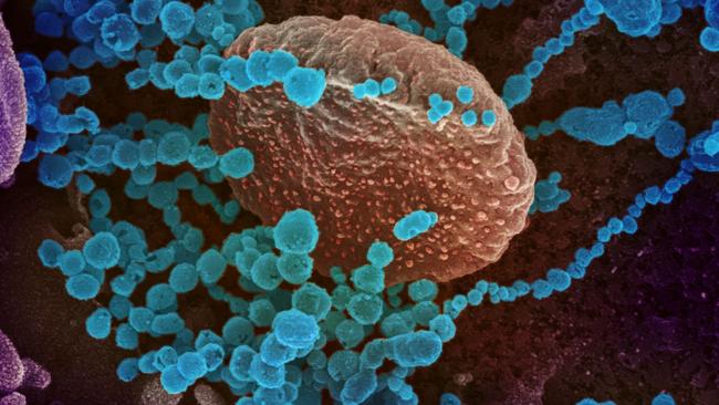 This image obtained March 12, 2020 courtesy of The National Institutes of Health(NIH)/NIAD-RML shows a scanning electron microscope image of SARS-CoV-2 (round blue objects) emerging from the surface of cells cultured in the lab, SARS-CoV-2, also known as 2019-nCoV, is the virus that causes COVID-19, the virus shown was isolated from a patient in the US. - US President Donald Trump announced a shock 30-day ban on travel from mainland Europe over the coronavirus pandemic that has sparked unprecedented lockdowns, widespread panic and another financial market meltdown March 12, 2020. Trump's unexpected move in a primetime TV address from the Oval Office pummelled stock markets, as traders fretted about the economic impact of the outbreak that is on a seemingly relentless march across the planet. (Photo by Handout / National Institutes of Health / AFP) / RESTRICTED TO EDITORIAL USE - MANDATORY CREDIT "AFP PHOTO /NATIONAL INSTITUTES OF HEALTH/NIAD-RML/HANDOUT " - NO MARKETING - NO ADVERTISING CAMPAIGNS - DISTRIBUTED AS A SERVICE TO CLIENTS