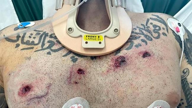 Sam “The Punisher” Abdulrahim shows off his bullet wounds in hospital. Picture: Supplied