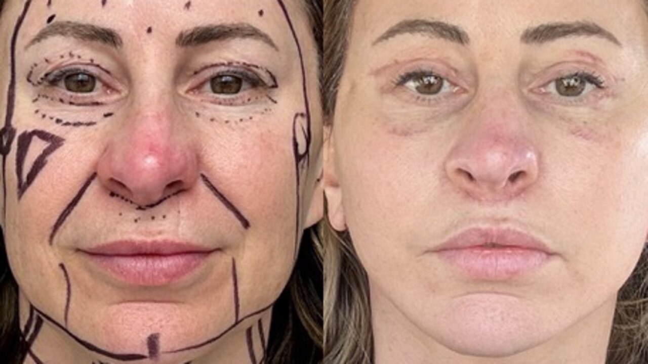 Kelly Beasley, 50, sold her house and used the earnings to pay for a plastic surgery overhaul. Picture: SWNS