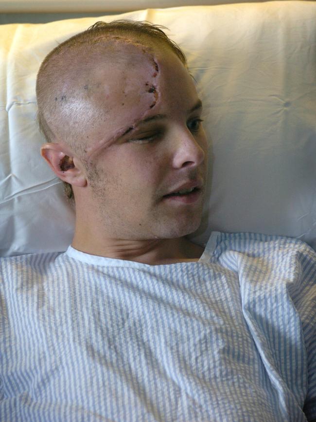 Road rage accident victim Damian De Wit, who was hit by a brick thrown through his windscreen while driving, in hospital after emerging from coma 28 Jan 2005.