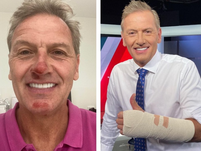 While riding in a sponsors event, Adelaide TV and radio favourite Mark Soderstrom fell off his bike and injured himself.