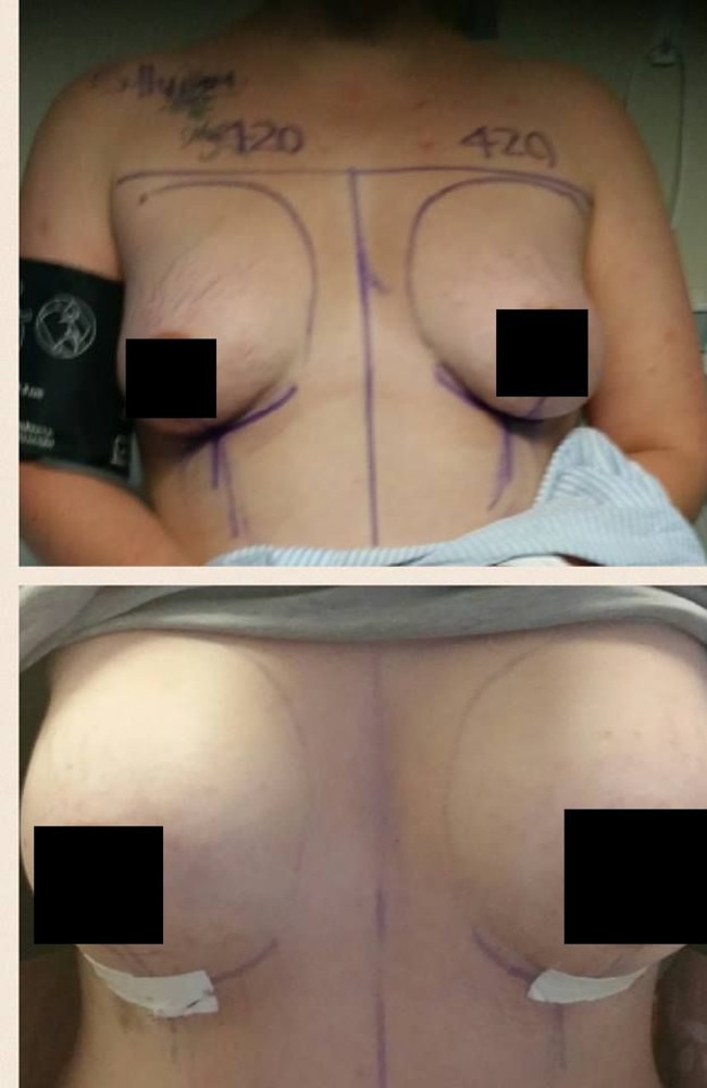 Top: Before the surgery. Bottom: One week post-surgery.