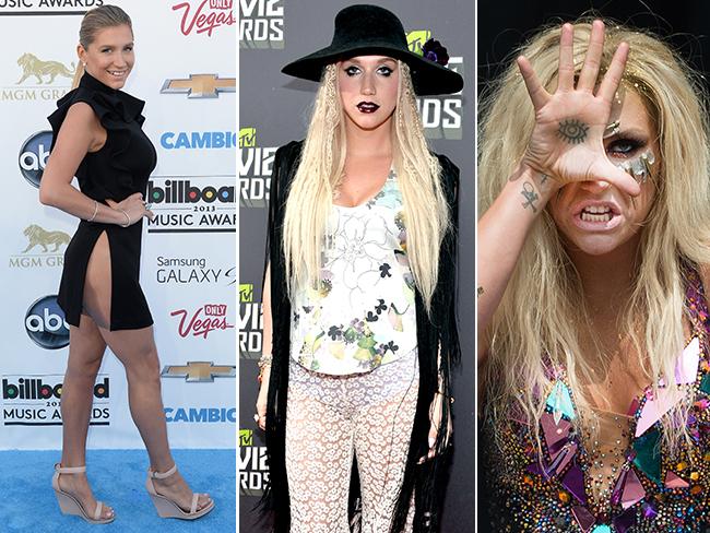 Ke$ha. Picture: Getty