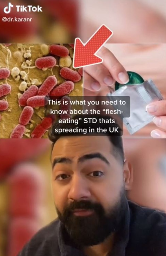 A doctor on TikTok recently shared a video warning British people about a ‘flesh-eating STI’. Picture: TikTok/dr.karanr