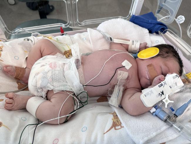 New mum tells harrowing tale of how Roma’s cutest baby was born