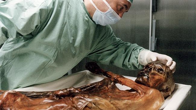  A researcher prepares to take samples of the 5,300yr-old mummy known as Oetzi (otzi) in this pic released by the /South /Tyr...