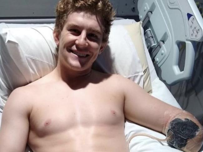 A British backpacker had his trip of a lifetime turn into a harrowing ordeal after a freak incident during stint at a remote cattle station in the Northern Territory.