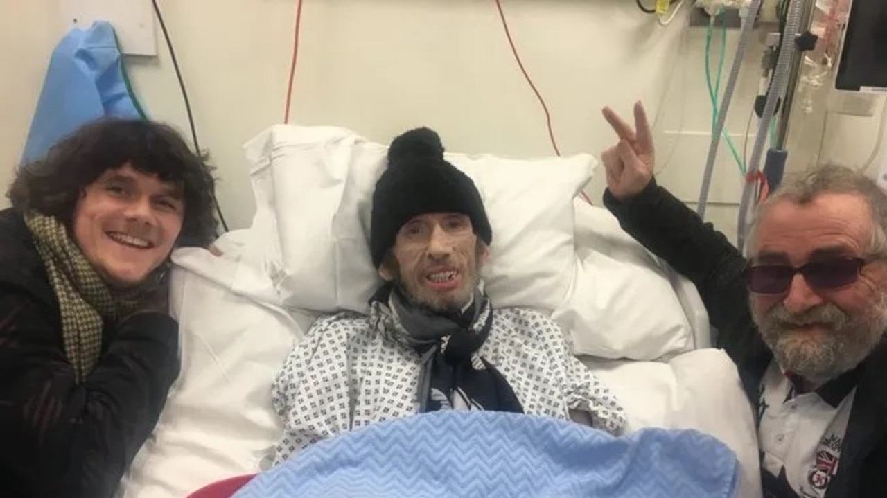 Heartbreaking pictures of iconic rock star Shane MacGowan of Pogues