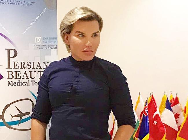 Rodrigo Alves has had more surgery. Picture: Rodrigo Alves/Instagram