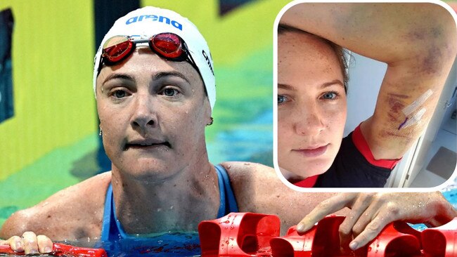 Cate Campbell shared images of her injuries on social media