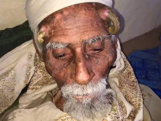 He went viral for his "devil horns" which began growing when he was 100. Picture: CEN