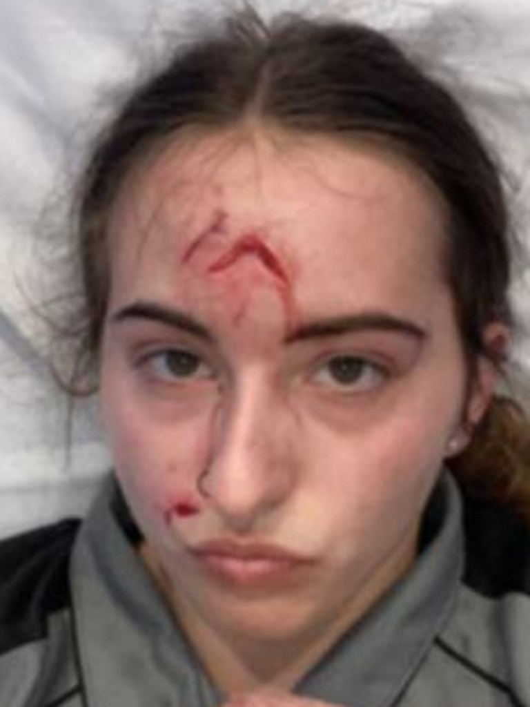 Her friends reacted quickly and called an ambulance. Picture: Supplied