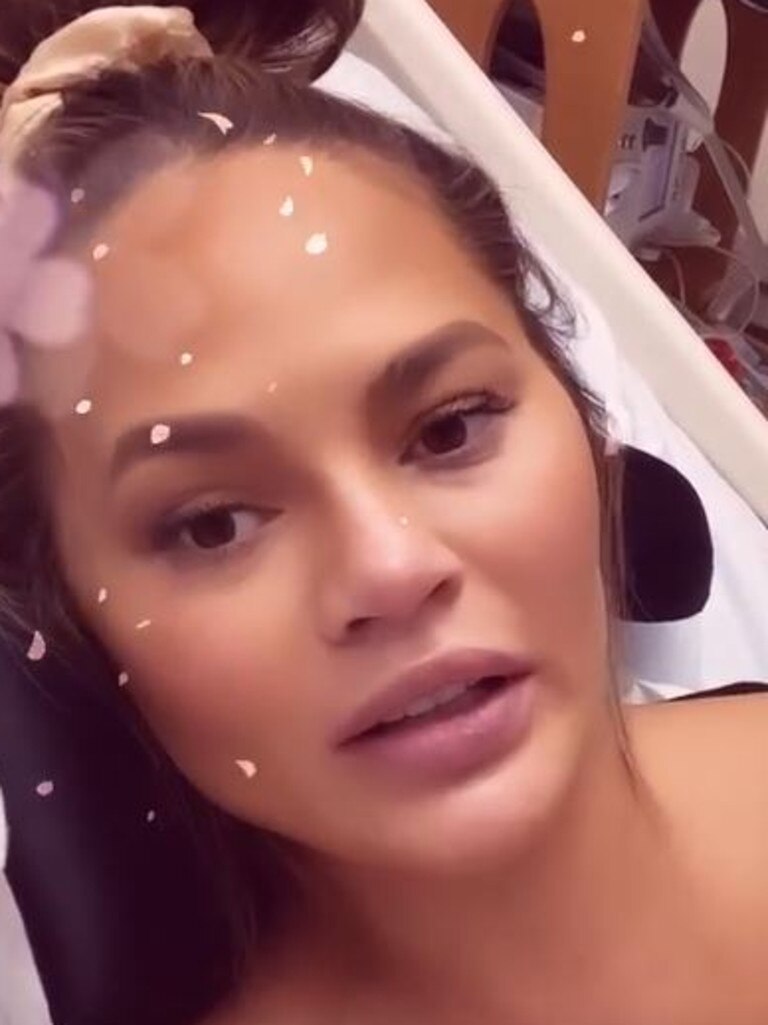 Chrissy Teigen speaks from hospital.