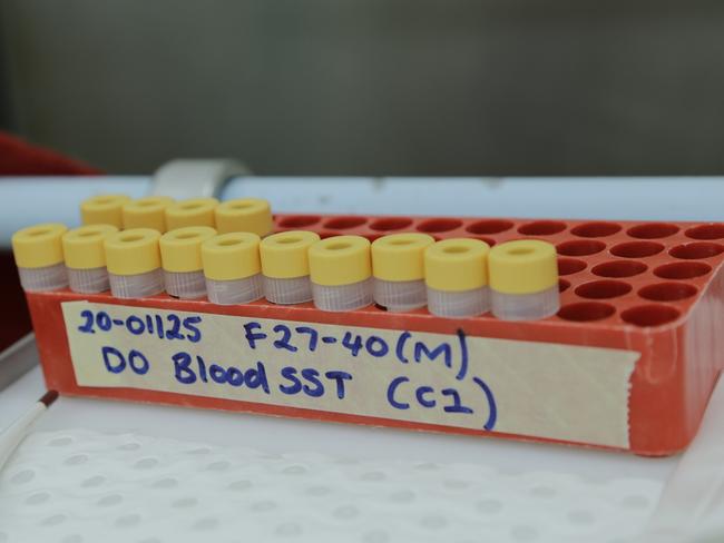 The CSIRO is testing COVID-19 vaccine candidates for efficacy. Picture: Supplied