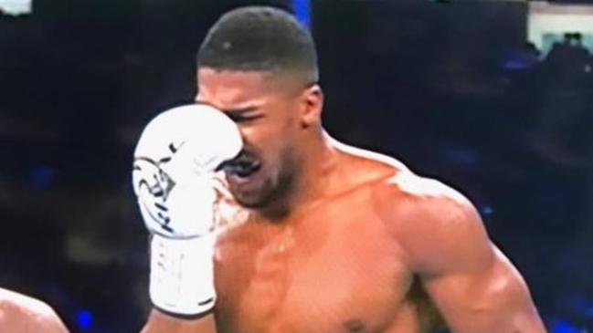 Anthony Joshua is in a world of pain.