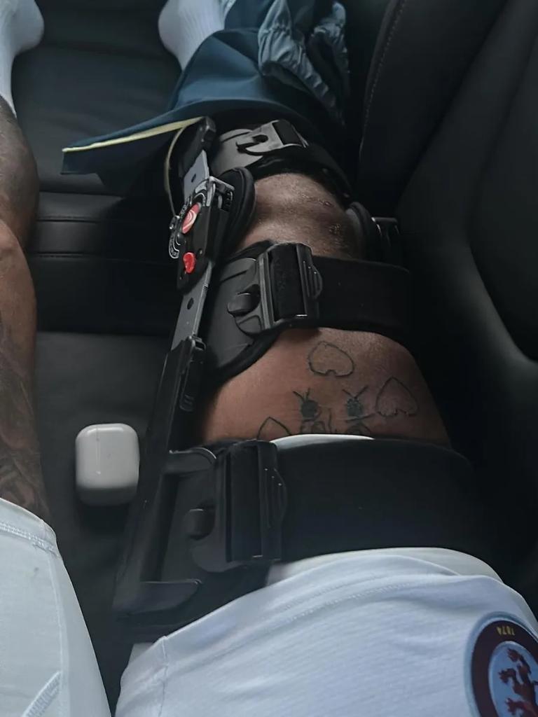 Mings' leg in a brace